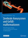 Bild: Zerebrale Aneurysmen und Gefäßmalformationen - Springer
