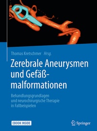 Bild: Zerebrale Aneurysmen und Gefäßmalformationen - Springer
