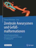 Abbildung von: Zerebrale Aneurysmen und Gefäßmalformationen - Springer