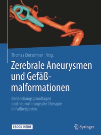 Abbildung von: Zerebrale Aneurysmen und Gefäßmalformationen - Springer