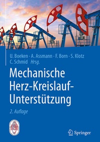 Abbildung von: Mechanische Herz-Kreislauf-Unterstützung - Springer