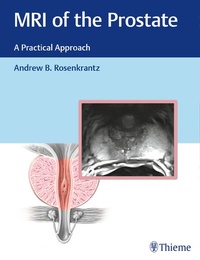 Abbildung von: MRI of the Prostate - Thieme Publishers