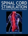 Cover: Spinal Cord Stimulation - OUP eBook