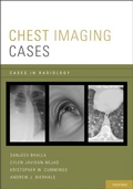 Cover: Chest Imaging Cases - OUP eBook