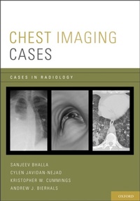 Bild vergrößern Bild: Chest Imaging Cases - OUP eBook