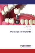 Cover: Occlusion in implants - LAP Lambert Academic Publishing