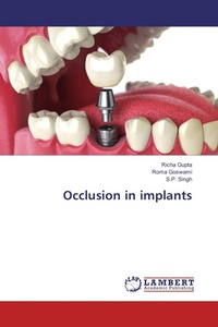 Enlarge image Cover: Occlusion in implants - LAP Lambert Academic Publishing