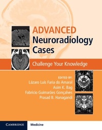 Abbildung von: Advanced Neuroradiology Cases - Cambridge University Press