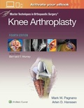 Cover: Master Techniques in Orthopedic Surgery: Knee Arthroplasty - Lippincott Williams and Wilkins