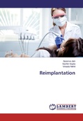 Cover: Reimplantation - LAP Lambert Academic Publishing