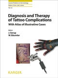 Cover: Diagnosis and Therapy of Tattoo Complications - S. Karger