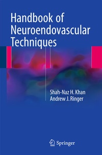 Abbildung von: Handbook of Neuroendovascular Techniques - Springer