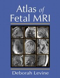 Cover: Atlas of Fetal MRI - CRC Press