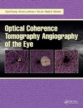 Cover: Optical Coherence Tomography Angiography of the Eye - SLACK  Incorporated
