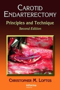 Cover: Carotid Endarterectomy - CRC Press