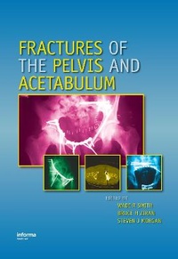 Enlarge image Cover: Fractures of the Pelvis and Acetabulum - CRC Press