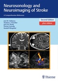 Abbildung von: Neurosonology and Neuroimaging of Stroke - Thieme