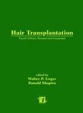 Cover: Hair Transplantation, Fourth Edition - Marcel Dekker Inc