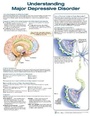 Cover: Understanding Major Depressive Disorder - Lippincott Williams and Wilkins