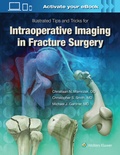 Cover: Illustrated Tips and Tricks for Intraoperative Imaging in Fracture Surgery - Lippincott Williams and Wilkins