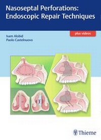 Abbildung von: Nasoseptal Perforations: Endoscopic Repair Techniques - Thieme