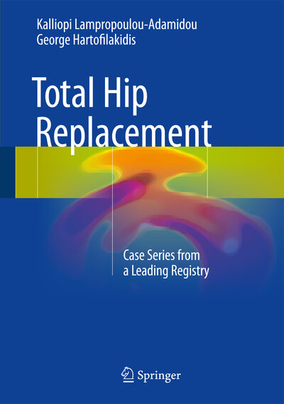 Abbildung von: Total Hip Replacement - Springer