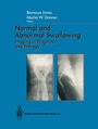 Cover: Normal and Abnormal Swallowing - Springer