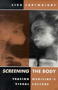 Abbildung von: Screening the Body - University of Minnesota Press