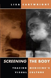 Enlarge image Cover: Screening the Body - University of Minnesota Press