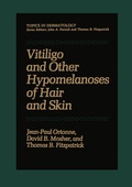 Cover: Vitiligo and Other Hypomelanoses of Hair and Skin - Springer