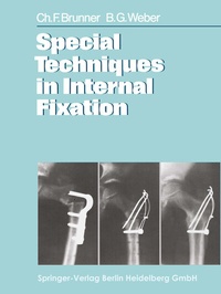 Enlarge image Cover: Special Techniques in Internal Fixation - Springer