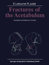 Enlarge image Cover: Fractures of the Acetabulum - Springer