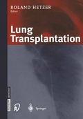 Bild: Lung Transplantation - Steinkopff