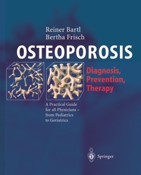 Abbildung von: OSTEOPOROSIS - Springer
