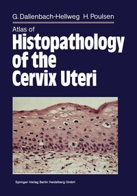 Abbildung von: Atlas of Histopathology of the Cervix Uteri - Springer