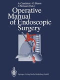 Bild: Operative Manual of Endoscopic Surgery - Springer