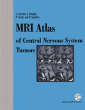 Bild: MRI Atlas of Central Nervous System Tumors - Springer