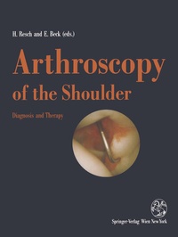 Abbildung von: Arthroscopy of the Shoulder - Springer