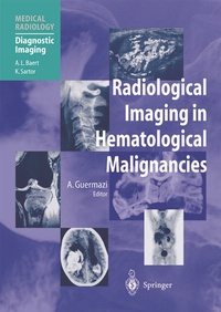 Abbildung von: Radiological Imaging in Hematological Malignancies - Springer