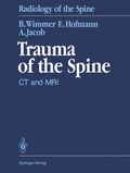 Cover: Trauma of the Spine - Springer