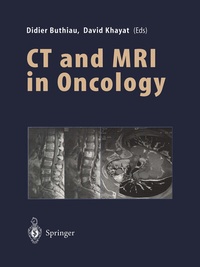 Abbildung von: CT and MRI in Oncology - Springer