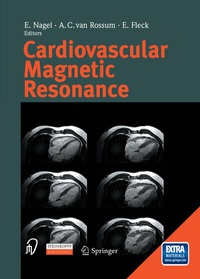 Abbildung von: Cardiovascular Magnetic Resonance - Steinkopff