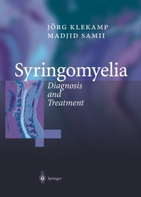 Bild: Syringomyelia - Springer