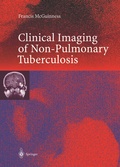 Bild: Clinical Imaging in Non-Pulmonary Tuberculosis - Springer