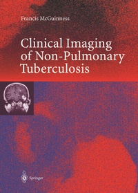 Abbildung von: Clinical Imaging in Non-Pulmonary Tuberculosis - Springer