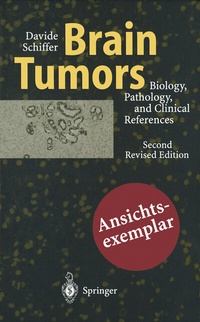 Bild: Brain Tumors - Springer