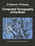 Bild: Computed Tomography of the Brain - Springer