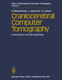 Enlarge image Cover: Atlas of Pathological Computer Tomography - Springer