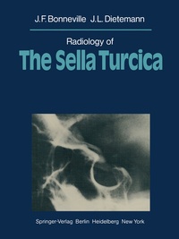 Abbildung von: Radiology of The Sella Turcica - Springer