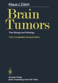 Bild: Brain Tumors - Springer